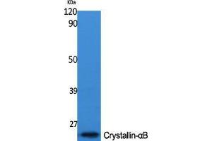 Western Blot (WB) analysis of specific cells using Crystallin-alphaB Polyclonal Antibody. (CRYAB antibody  (Ser268))