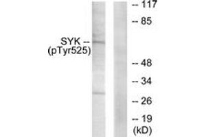 Western blot analysis of extracts from A549 cells, using SYK (Phospho-Tyr525) Antibody. (SYK antibody  (pTyr525))