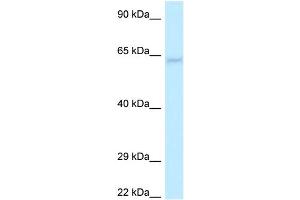 WB Suggested Anti-LGI1 Antibody Titration: 1. (LGI1 antibody  (N-Term))