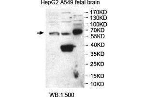 Western blot analysis of HepG2, A549 and fetal brain lysates, using SNTG2 antibody.