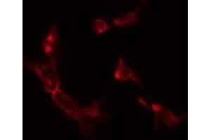 ABIN6275335 staining K562 by IF/ICC. (OAT antibody  (Internal Region))