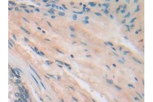 Immunohistochemistry (IHC) image for anti-Integrin beta 5 (ITGB5) (AA 137-378) antibody (ABIN7440758)