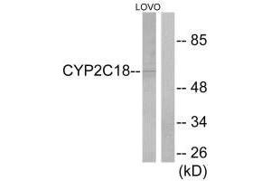 Western blot analysis of extracts from LOVO cells, using Cytochrome P450 2C8/9/18/19 antibody.