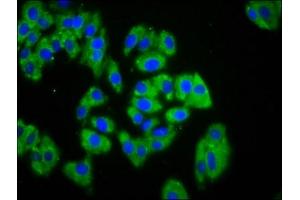 Immunofluorescence staining of HepG2 cells with ABIN7167509 at 1:133, counter-stained with DAPI. (PTPRK antibody  (AA 589-749))