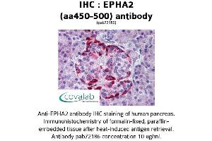 Image no. 1 for anti-EPH Receptor A2 (EPHA2) (AA 450-500) antibody (ABIN1734074) (EPH Receptor A2 antibody  (AA 450-500))