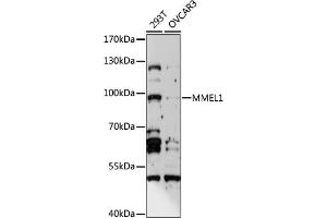 Western blot analysis of extracts of various cell lines, using MMEL1 antibody (ABIN6293386) at 1:1000 dilution. (MMEL1 antibody)