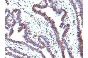 Immunohistochemistry (Formalin-fixed Paraffin-embedded Sections) (IHC (fp)) image for anti-F-Box Protein 5 (FBXO5) (AA 1-250) antibody (ABIN3024717)