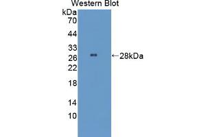 Figure. (STING/TMEM173 antibody  (AA 160-371))
