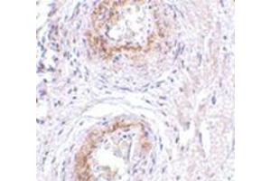 Immunohistochemistry of TEM5 in human bladder tissue with this product at 5 μg/ml. (GPR124 antibody  (C-Term))