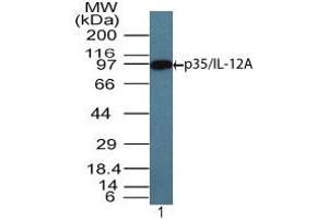 Image no. 1 for anti-Interleukin 12 alpha (IL12A) (AA 200-250) antibody (ABIN960224) (IL12A antibody  (AA 200-250))