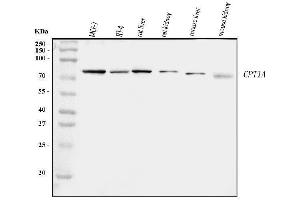 Western blot analysis of CPT1A using anti-CPT1A antibody (ABIN7599853).