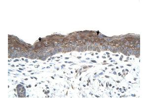 LOC400856 antibody was used for immunohistochemistry at a concentration of 4-8 ug/ml to stain Squamous epithelial cells (arrows) in Human Skin. (LOC400856 antibody  (C-Term))