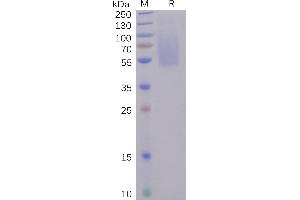 SDS-PAGE (SDS) image for SARS-CoV-2 Spike S1 (N-Term) protein (His tag) (ABIN6961171)