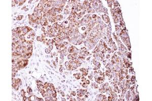 IHC-P Image Immunohistochemical analysis of paraffin-embedded SW480 Xenograft, using LRP130 , antibody at 1:100 dilution.