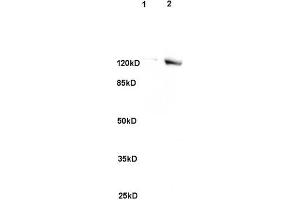 L1 rat brain, L2 human colon carcinoma lysates probed (ABIN741705) at 1:200 in 4 °C. (SREBF2 antibody)
