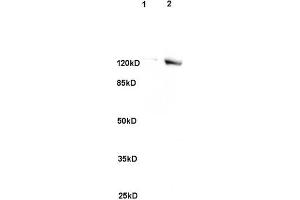 L1 rat brain, L2 human colon carcinoma lysates probed (ABIN741705) at 1:200 in 4 °C. (SREBF2 antibody)