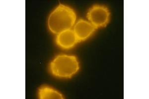 Detection of CD34 in human chronic myeloid leukemia cell line MOLM-7 with anti-human CD34 PE. (CD34 antibody  (FITC))