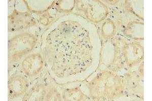 Immunohistochemistry of paraffin-embedded human kidney tissue using ABIN7155229 at dilution of 1:100 (HIATL1 antibody  (AA 450-506))