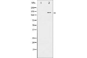 Western blot analysis of HDAC5 phosphorylation expression in HepG2 whole cell lysates,The lane on the left is treated with the antigen-specific peptide. (HDAC5 antibody  (pSer259))