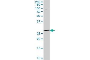 TFPI2 MaxPab rabbit polyclonal antibody. (TFPI2 antibody  (AA 1-235))