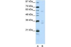 WB Suggested Anti-ZNF440 Antibody Titration:  2. (ZNF440 antibody  (N-Term))