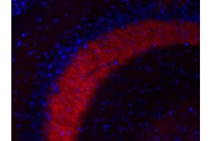 Indirect immunofluorescence labeling of a PFA fixed mouse hippocampus section (dilution 1 : 200; red). (MAL2 antibody  (AA 13-28))