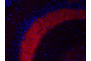 Indirect immunofluorescence labeling of a PFA fixed mouse hippocampus section (dilution 1 : 200; red).