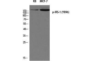 Western Blot analysis of 1) KB, 2) MCF7 cells using Phospho-IRS1 (Tyr896) Polyclonal Antibody at dilution of 1:500 (IRS1 antibody  (pTyr896))