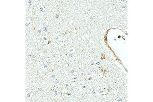 Immunohistochemistry of paraffin-embedded human brain using MMP7 Rabbit mAb (ABIN7268425) at dilution of 1:150 (40x lens). (MMP7 antibody)