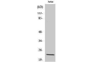 Western Blotting (WB) image for anti-Suppressor of Cytokine Signaling 2 (SOCS2) antibody (ABIN5957631) (SOCS2 antibody)