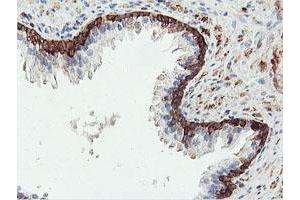 Image no. 1 for anti-phosphofructokinase, Platelet (PFKP) antibody (ABIN1500160)