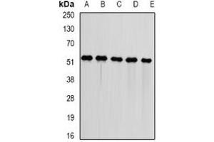 Western blot analysis of DNAJA3 expression in Jurkat (A), HepG2 (B), mouse kidney (C), mouse heart (D), rat liver (E) whole cell lysates. (DNAJA3 antibody)