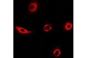 Immunofluorescent analysis of Transgelin-2 staining in MCF7 cells. (TAGLN2 antibody)