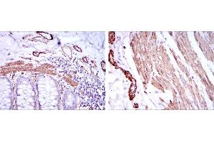 Immunohistochemical analysis of paraffin-embedded human duodenum tissues (left) and human esophagus tissues (right) using ACTA2 mouse mAb with DAB staining. (Smooth Muscle Actin antibody)