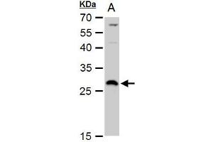 WB Image DCK antibody detects DCK protein by western blot analysis. (DCK antibody  (Center))