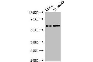 Western Blot Positive WB detected in: Mouse lung tissue, Mouse stomach tissue All lanes: GAD2 antibody at 2. (GAD65 antibody  (AA 1-82))
