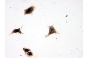 IHC analysis of SQSTM1 using anti-SQSTM1 antibody (ABIN3043937). (SQSTM1 antibody  (N-Term))