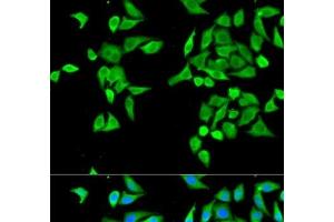 Immunofluorescence analysis of MCF-7 cells using CES2 Polyclonal Antibody (CES2 antibody)