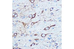 Immunohistochemistry of paraffin-embedded mouse brain using NMD Rabbit pAb (ABIN6133733, ABIN6141400, ABIN6141403 and ABIN6223602) at dilution of 100 (40x lens). (GRIN1/NMDAR1 antibody  (AA 600-700))
