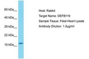 Image no. 1 for anti-Defensin, beta 119 (DEFB119) (N-Term) antibody (ABIN6750557) (DEFB119 antibody  (N-Term))