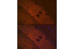 Immunofluorescence analysis of rat brain using mGluR2 Rabbit mAb (ABIN1682570, ABIN3017965, ABIN3017966 and ABIN7101551) at dilution of 1:100 (40x lens). (GRM2 antibody)