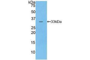 Western blot analysis of recombinant Human PKN1. (PKN1 antibody  (AA 615-874))