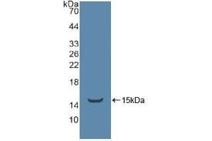 Western blot analysis of recombinant Human ADRbK1. (TEK antibody  (AA 1-116))