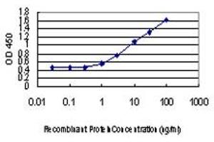 Detection limit for recombinant GST tagged IRF4 is approximately 0. (IRF4 antibody  (AA 342-451))