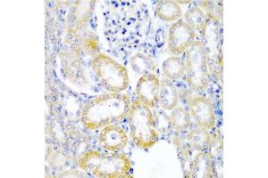 Immunohistochemistry of paraffin-embedded rat kidney using UPF2 antibody. (RENT2/UPF2 antibody)