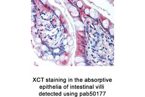 Image no. 2 for anti-Solute Carrier Family 7, (Cationic Amino Acid Transporter, Y+ System) Member 11 (SLC7A11) (AA 1-50), (N-Term) antibody (ABIN363486) (SLC7A11 antibody  (N-Term))