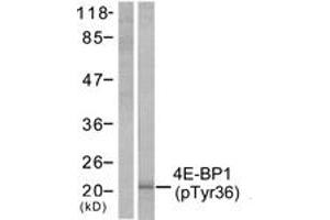 Western blot analysis of extracts from MDA-MB-435 cells treated with EGF 200ng/ml 30', using 4E-BP1 (Phospho-Thr36) Antibody. (eIF4EBP1 antibody  (pThr37))