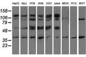 Western blot analysis of extracts (35 µg) from 9 different cell lines by using anti-CD5 monoclonal antibody. (CD5 antibody)