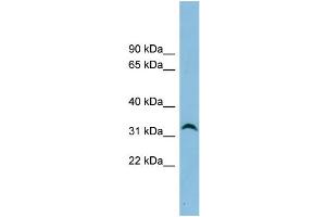 WB Suggested Anti-NXPH4 Antibody Titration: 0.