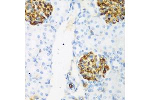 Immunohistochemistry of paraffin-embedded rat kidney using CSRNP1 antibody at dilution of 1:200 (40x lens). (AXUD1 antibody)